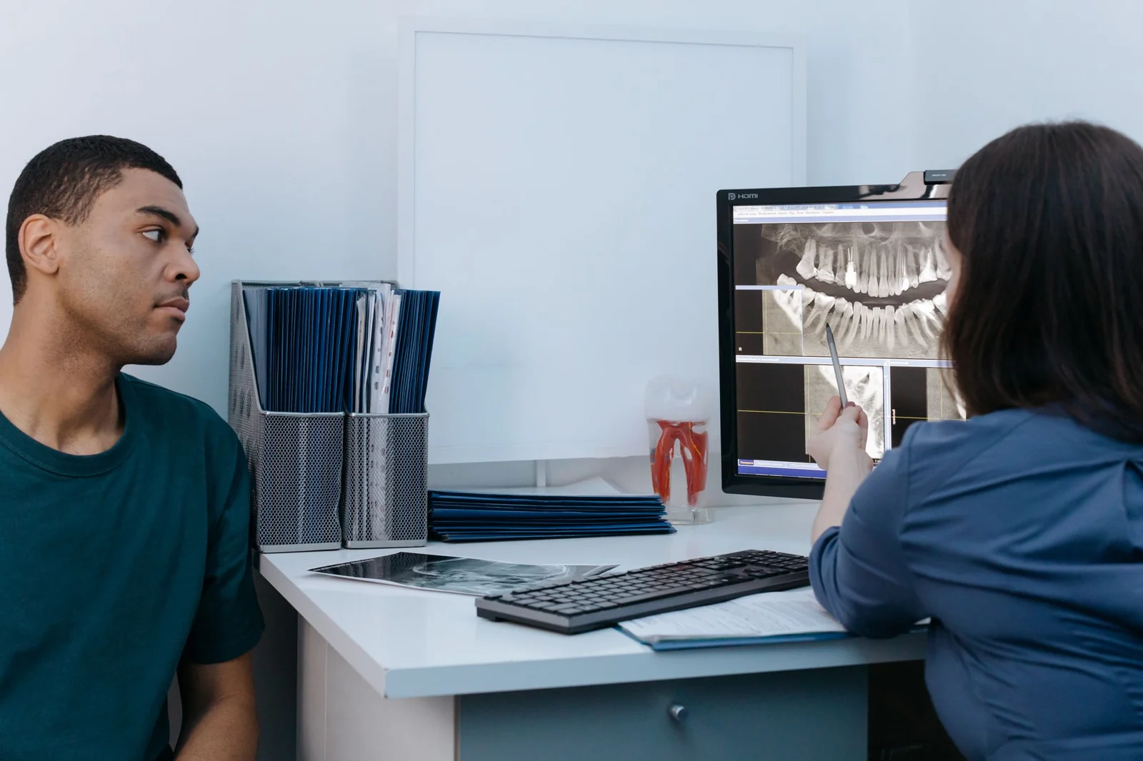 Implantes dentales