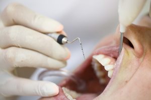 Centre Odontològic Sant Boi tratamiento periodoncia