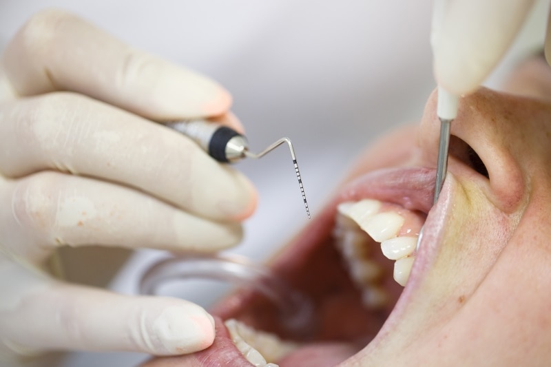 Centre Odontològic Sant Boi tratamiento periodoncia